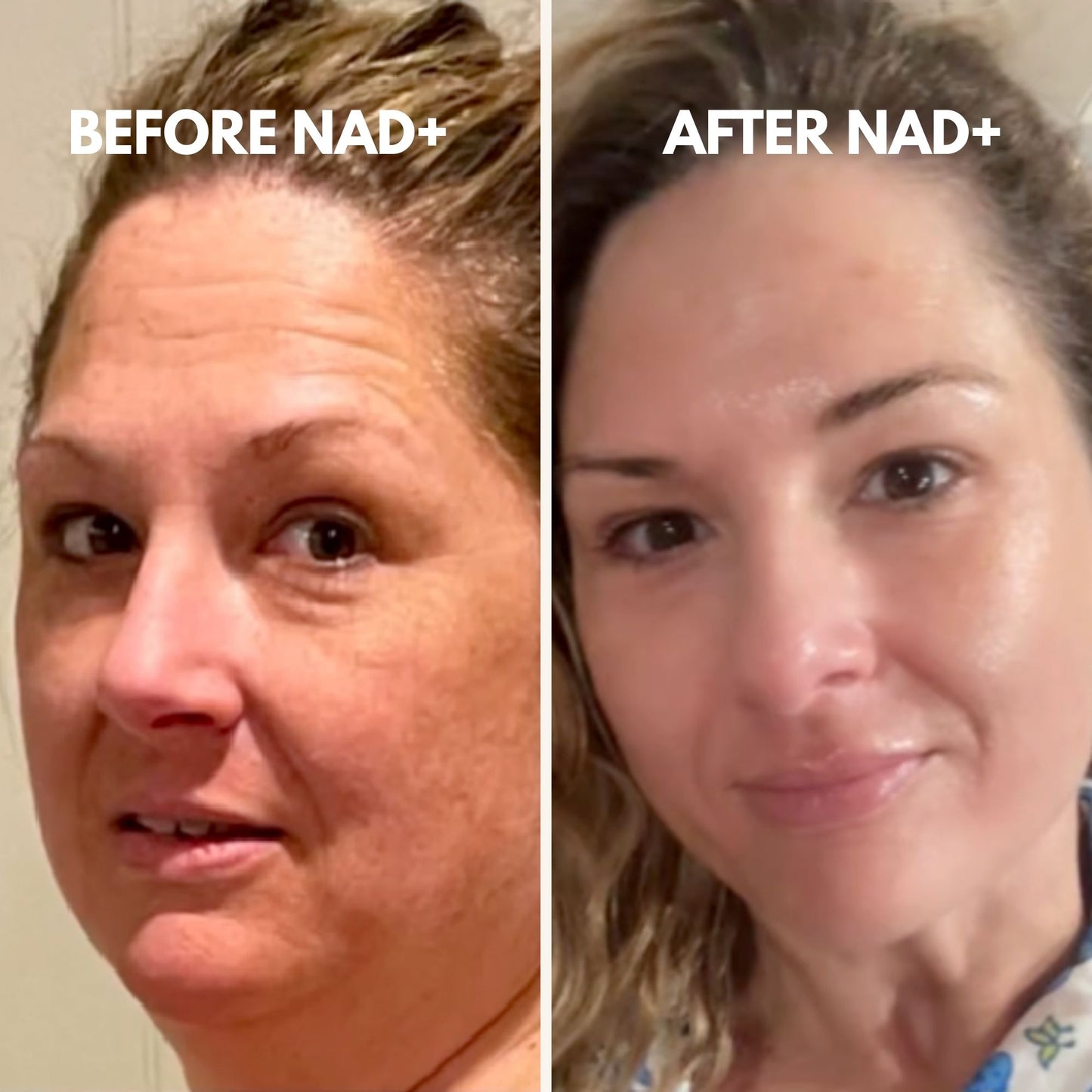 NAD+ Capsules